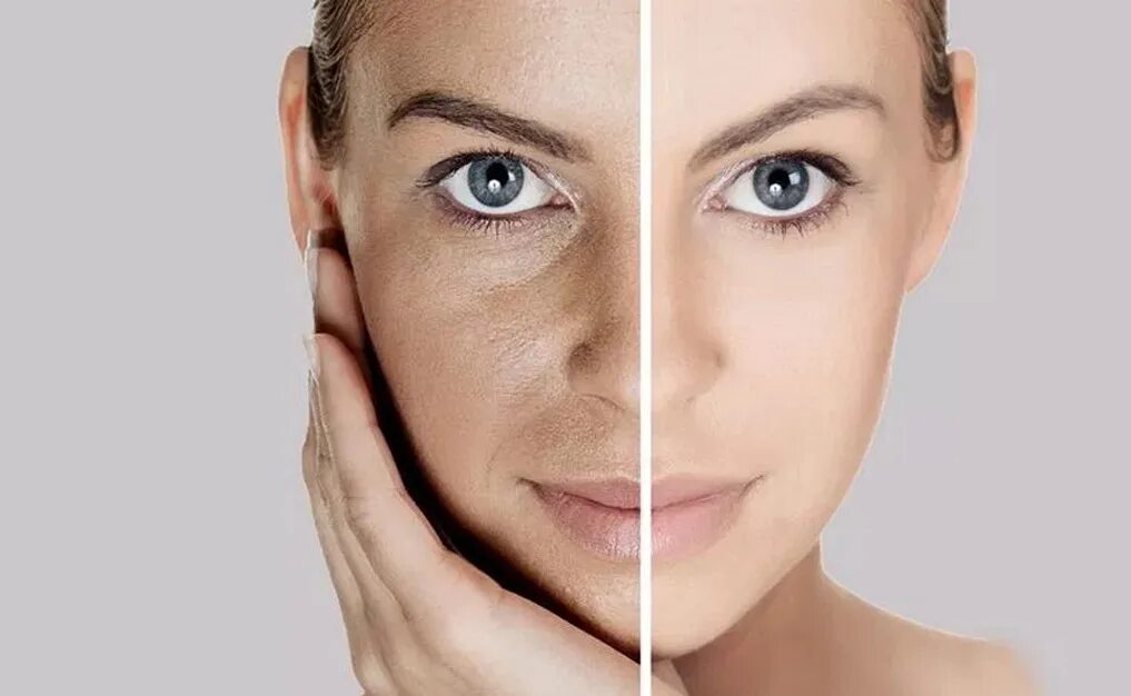 Age effect