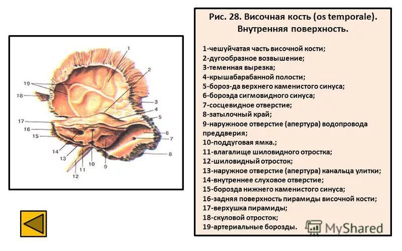 Пирамида (каменистая часть) височной кости. Строение височной кости черепа. Пирамида височной кости анатомия. Строение височной кости Синельников.