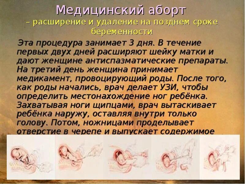 Хирургический медицинский аборт. Прерывание беременности натпоздних сроках. Аборт на поздних сроках беременности. Хирургический аборт на ранних сроках. До какой неделе делают прерывание