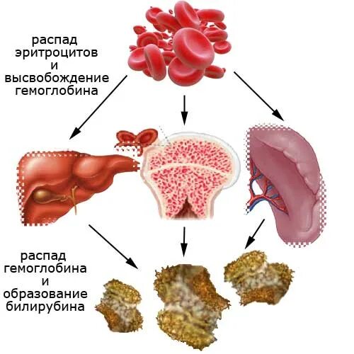 Распад эритроцитов. Билирубин. Разрушение билирубина. Разрушение эритроцитов и билирубин. Разрушение эритроцитов в печени.