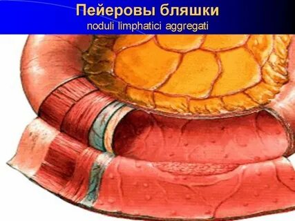 Бляшки кишечника