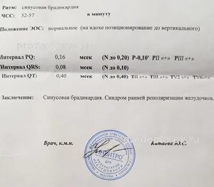 Экг в инвитро
