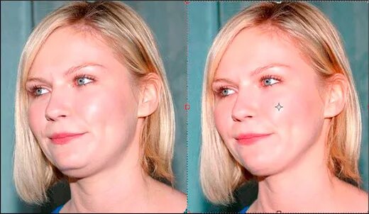 Второй подбородок. Двойной подбородок у худых. Второй подбородок фото. Pdtpls cj второй подбородок. Липосакция подбородка.