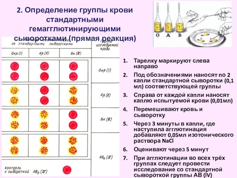 Группы крови 2 + 4 группа. Реакция агглютинации резус фактор. . Группы крови. Определение группы крови. Проба на совместимость. Методика определения группы крови стандартными сыворотками.