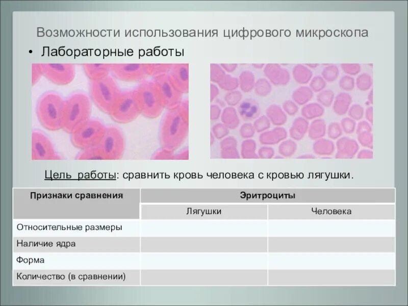 Лабораторная работа сравнение крови лягушки и человека. Кровь человека под микроскопом лабораторная работа. Кровь человека и лягушки под микроскопом. Сравнение крови человека с кровью лягушки. Лабораторная работа сравнение крови человека с кровью лягушки.