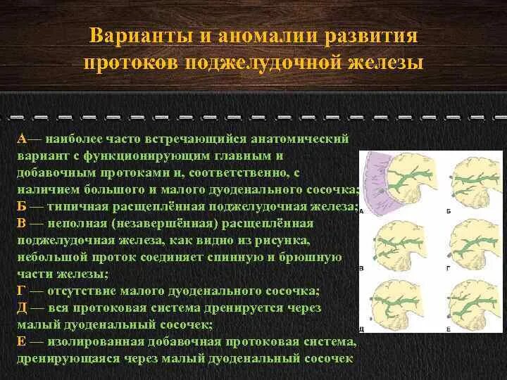 Аномалия статьи. Варианты развития поджелудочной железы. Аномалии протоков поджелудочной железы. Пороки развития поджелудочной железы. Аномалии развития поджелудочной железы классификация.