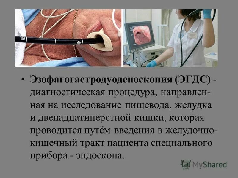 Эгдс и фгдс в чем разница что. Эндоскоп ФГДС колоноскоп. Эзофагогастродуоденоскопия (ЭГДС). Методика выполнения ЭГДС. Эзофагогастродуоденоскопия подготовка.