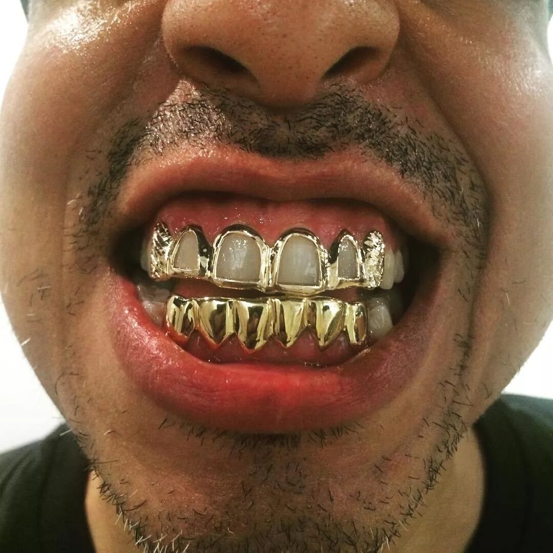 Сколько стоит металлические зубы