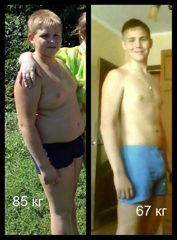 Подростки с лишним весом. Мальчик 11 лет похудел