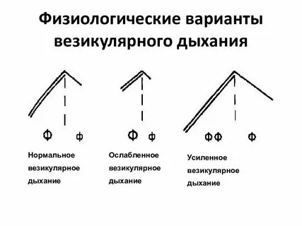Везикулярных хрипов