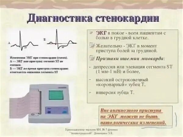 Экг при хронической ибс. Стенокардия напряжения экг признаки. Стенокардия напряжения экг признаки. Изменения экг характерные для стенокардии. Стабильная стенокардия экг.