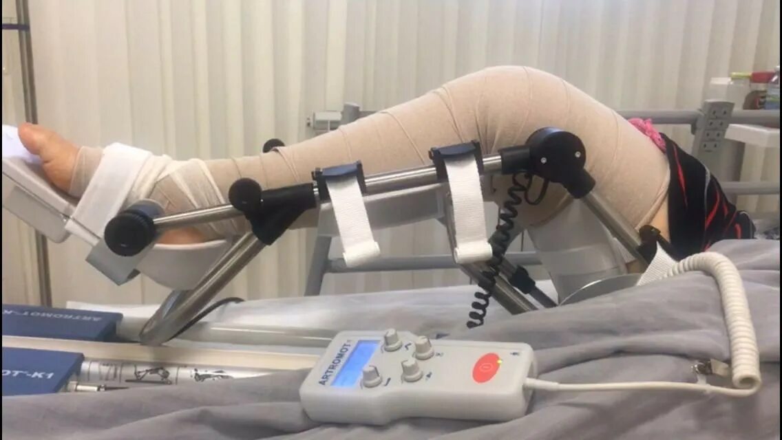 Мобилизация коленного сустава. Механотерапия Артромот. Аппарат ARTROMOT. Германские аппараты механотерапии «Артрамот. Артромот для коленного сустава.