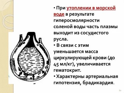 Утопление в морской воде