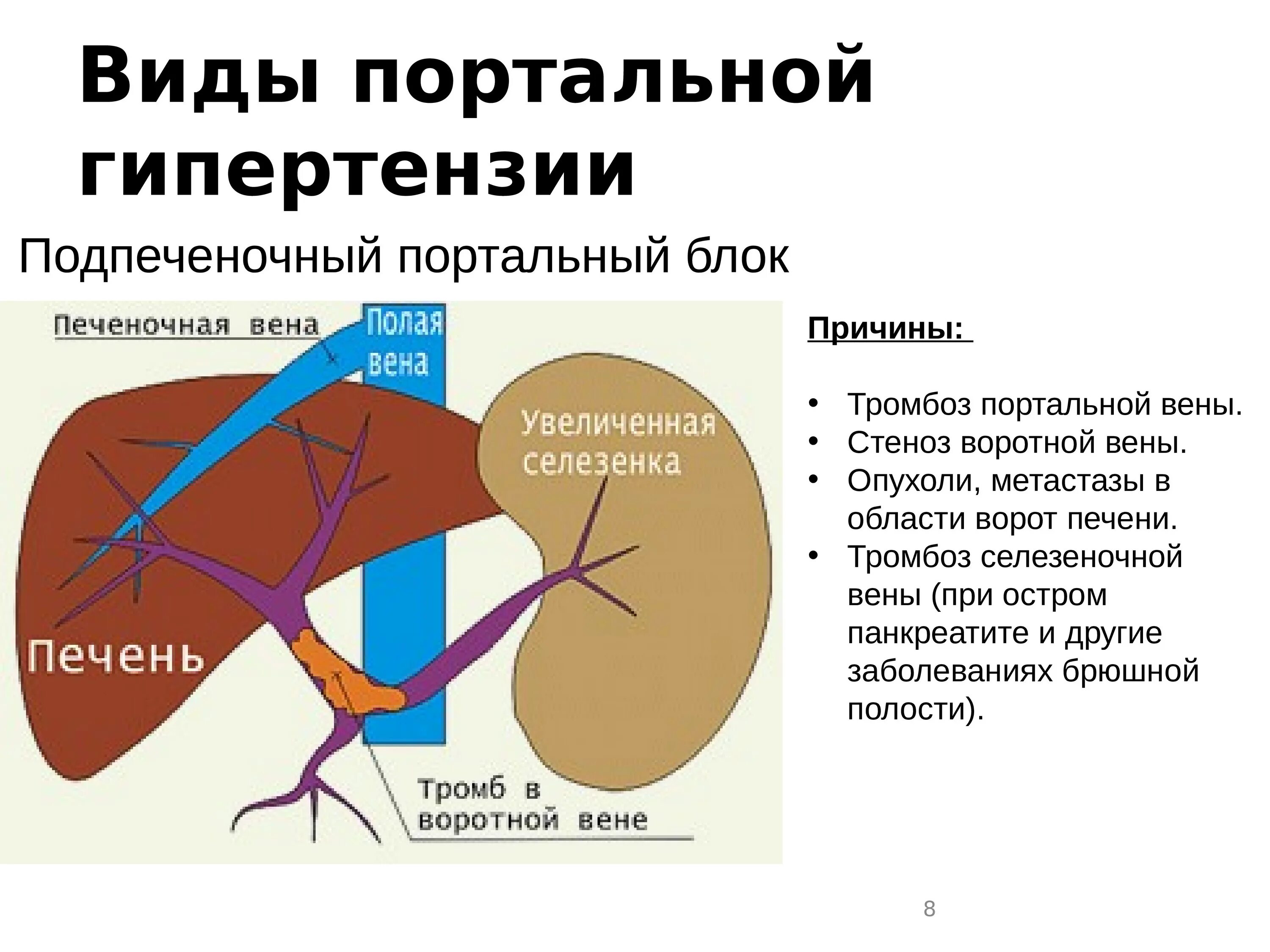 Основные синдромы при заболеваниях печени. Клинические и лабораторные синдромы при заболеваниях печени. Основные синдромы при патологии печени. Основные клинические синдромы при заболеваниях печени. Синдром больной печени