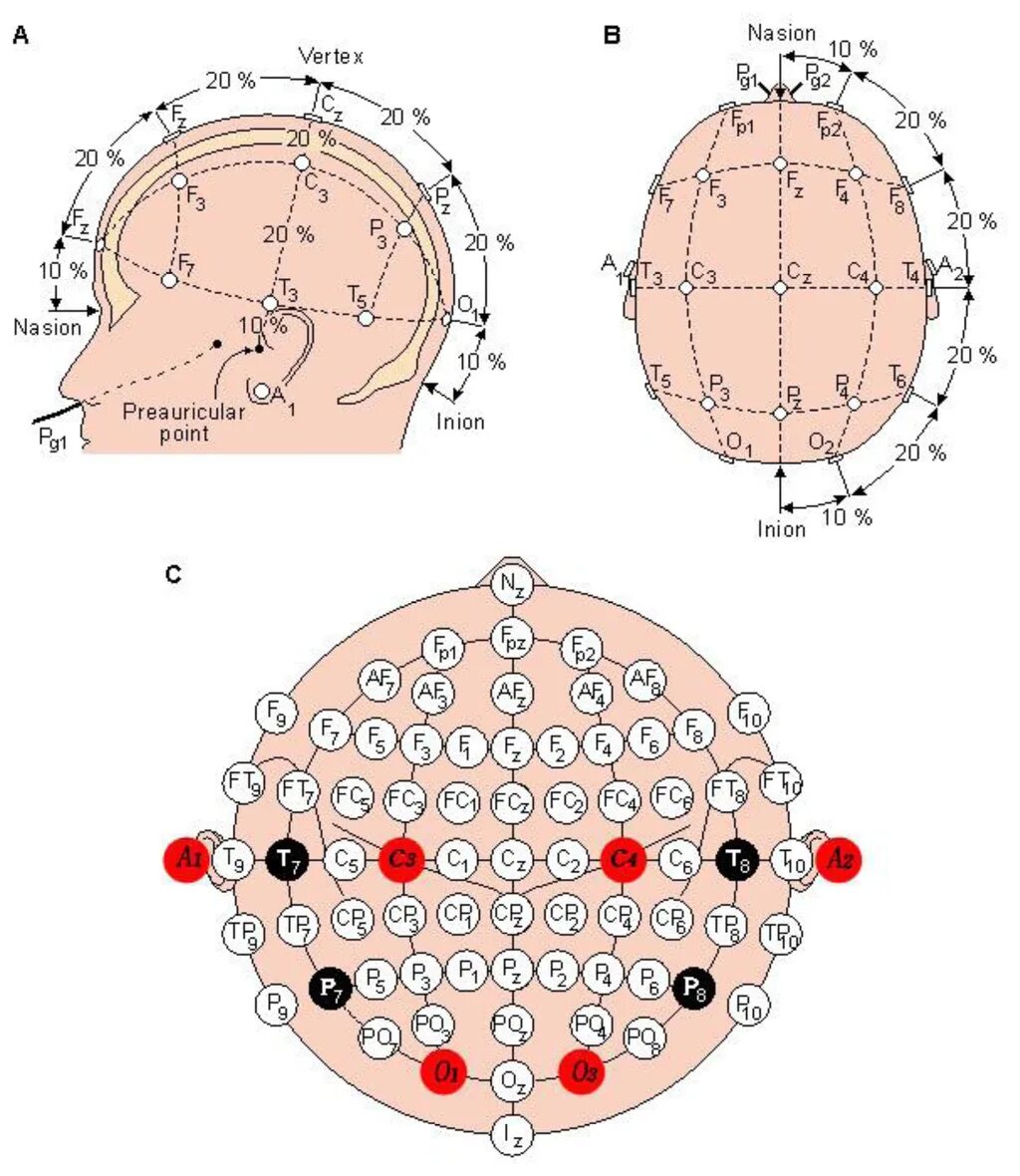 Схема ЭЭГ 10 электродов. Система 10-20 при ЭЭГ. Расположение электродов 10-20. Схема расположения электродов при ЭЭГ 10-20.