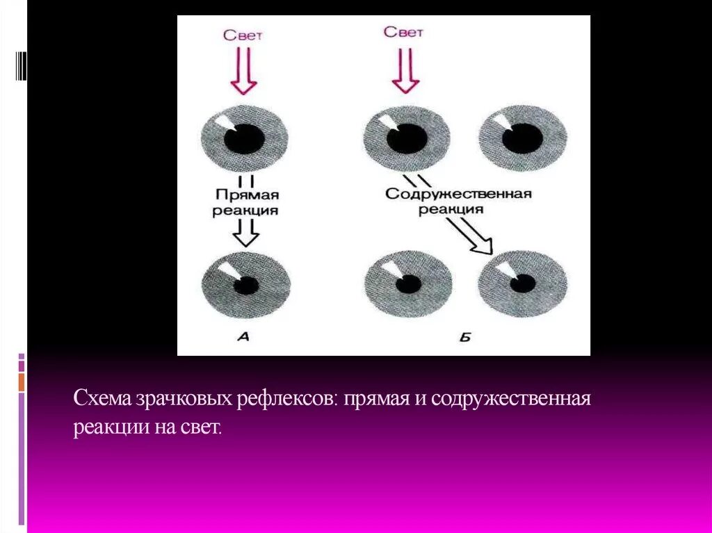 Реакция на свет зрачковый рефлекс. Прямая реакция зрачка на свет. Прямая и содружественная реакция зрачков. Исследование зрачковых реакций.