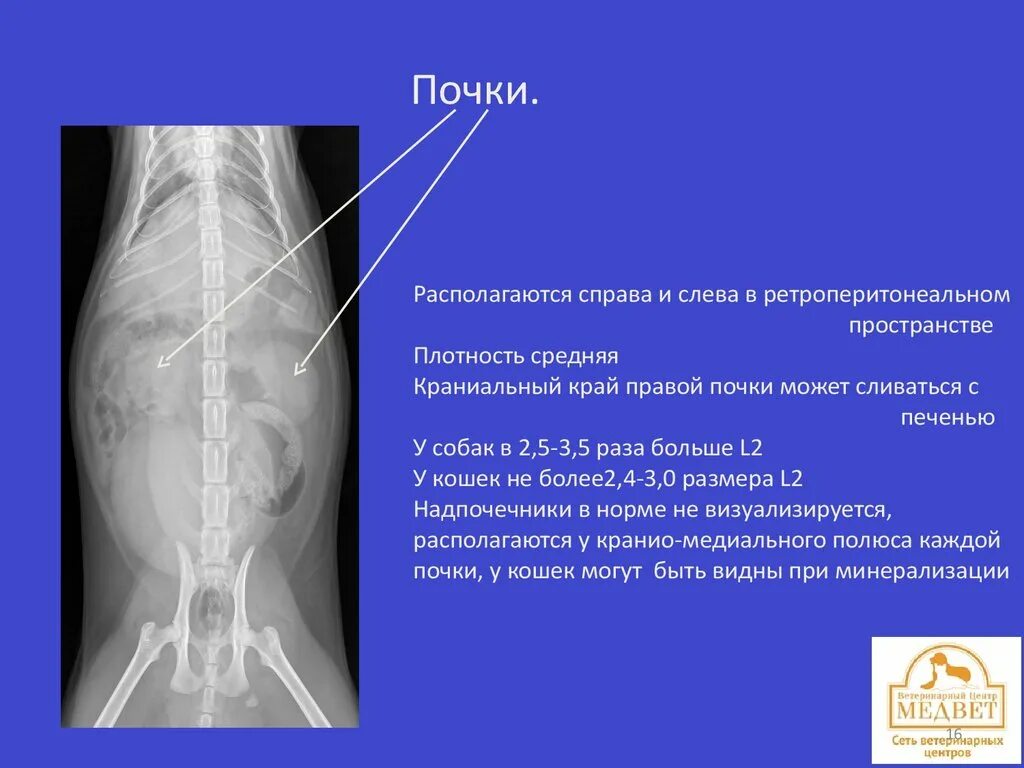 Как болит почка слева. Рентгенология. Почки слева или справа. Почки находятся справа или слева. Правило ленка рентгенология.