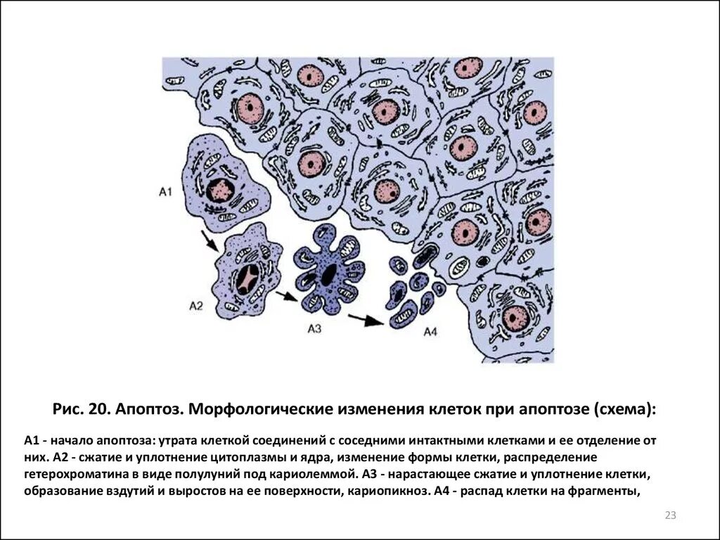 Структурно-функциональные изменения клеток при апоптозе.. Морфологические изменения клеток при некрозе. Основные морфологические признаки апоптоза. Апоптоз морфологические изменения при апоптозе.