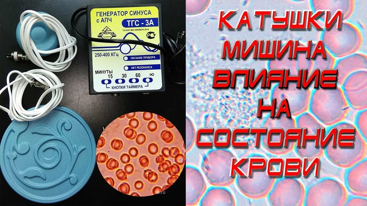 Катушка мишина отзывы. Катушка Мишина. Лечебные катушки Мишина. Прибор катушка Мишина. Магнитные катушки лечебные.