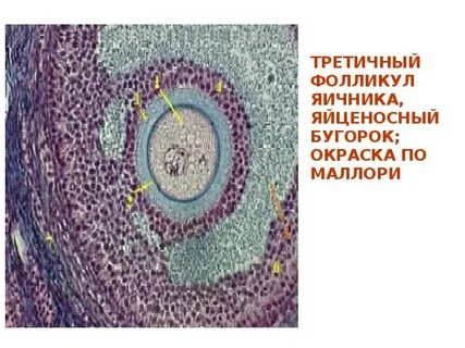 Фолликул 17 мм форум