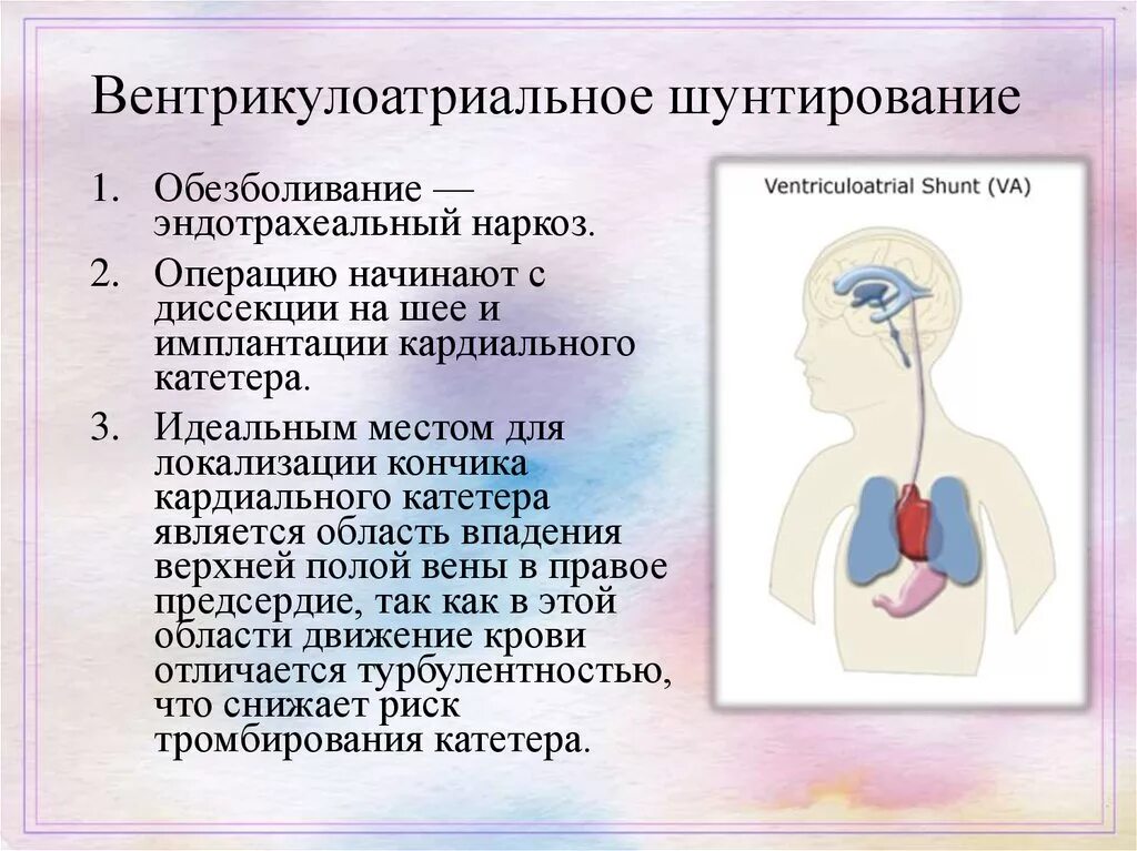 Вентрикулоперитонеальный шунт схема. Вентрикулоатриальный шунт. Шунтирующая операция гидроцефалия. Вентрикуло-перитонеальное шунтирование головного мозга.