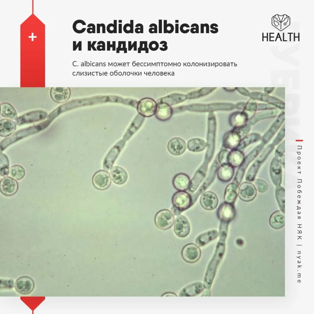 Candida чем лечить. Candida albicans 10 в 5. Колонии кандида альбиканс. Кандида альбиканс строение. Candida albicans под микроскопом.