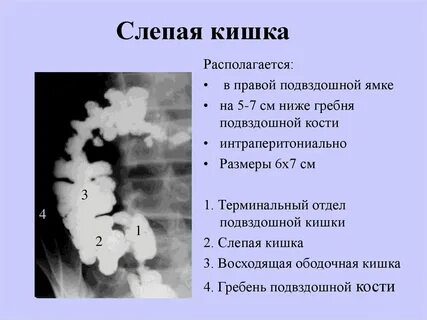 2 тип кишечника