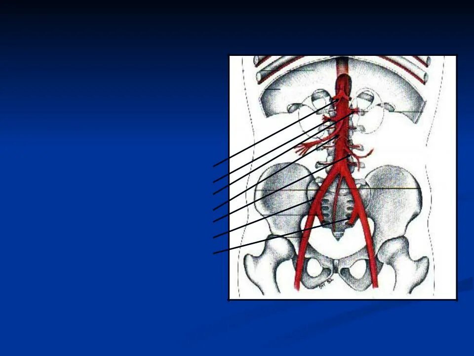 Ветви подвздошной артерии. Аорта подвздошные артерии. Яичниковая артерия и Вена. Брюшной отдел аорты подвздошные артерии.