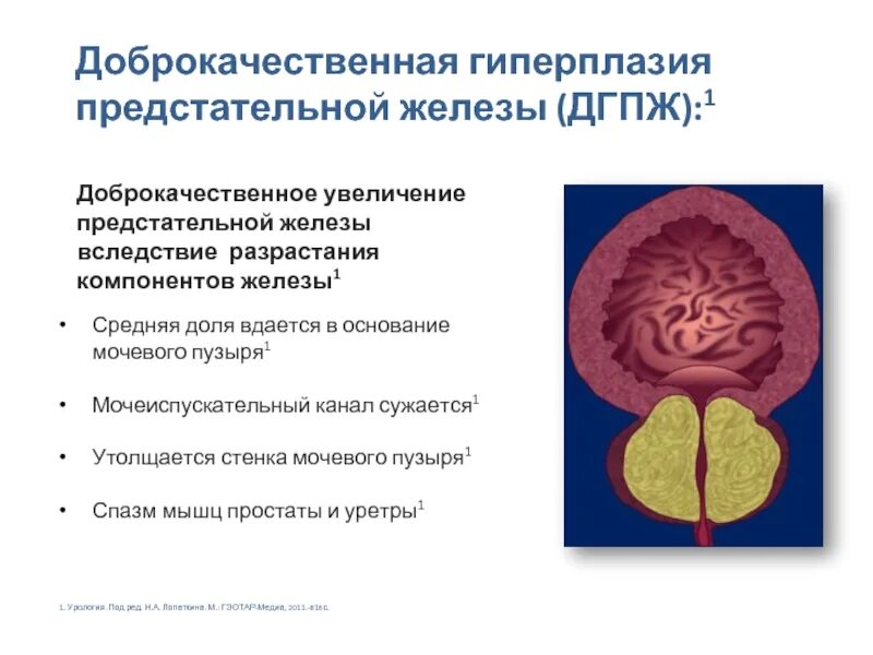 Как найти простату. Особенности строения простаты. Основная функция предстательной железы. Как найти простату. Аденома предстательной железы (аденома простаты).