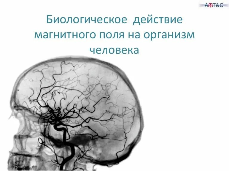 Магнитное поле и живые организмы. Влияние магнитного поля на человека. Влияние электромагнитных полей на живые организмы. Воздействие электромагнитных полей на человека. Механизм биологического действия магнитного поля..