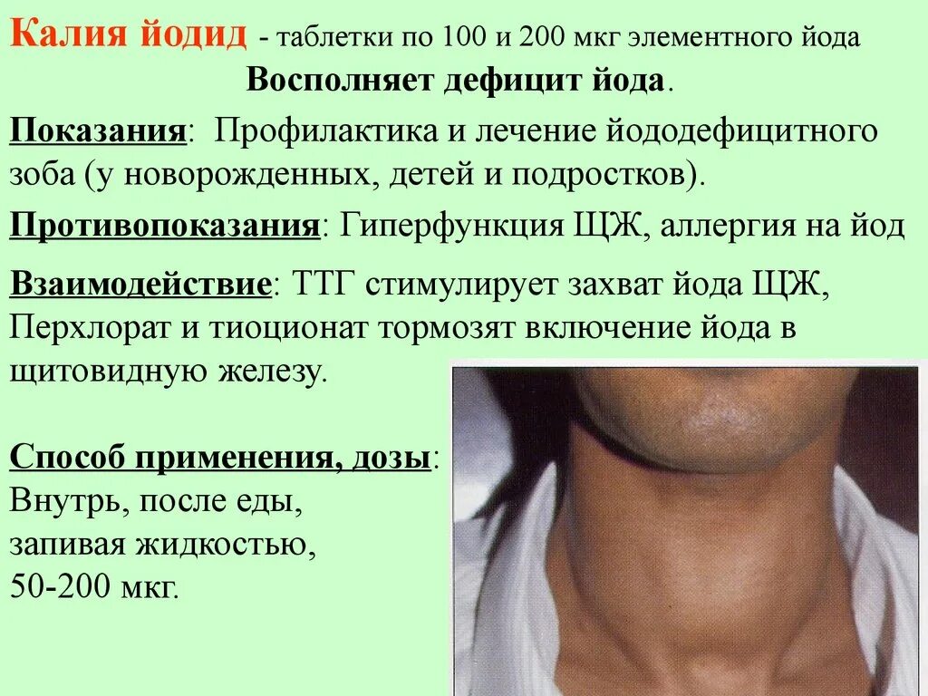 Что значит зоб. Заболевание щитовиднойжелезв. Заболевания щитовидной ж. Нарушение щитовидной железы болезни.