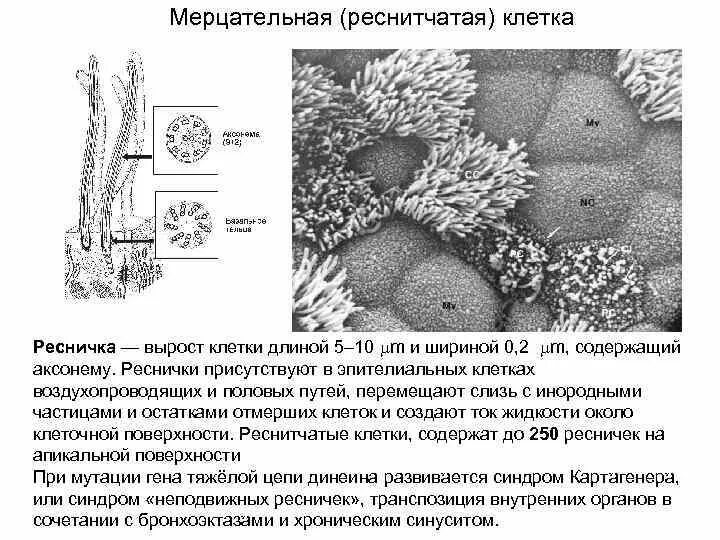 Реснитчатые клетки строение. Реснитчатые клетки функции. Мерцательные клетки. Мерцательные клетки функции. Медицинский препарат проникает в клетки мерцательного