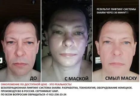 Лифтинг система