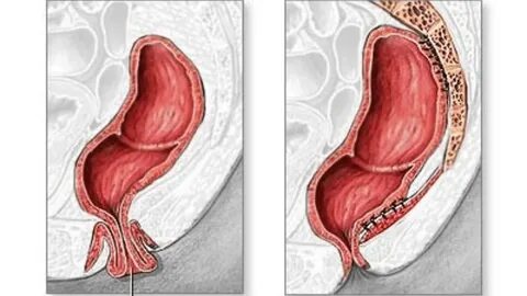 Порно маскүнем ретінде мас болды