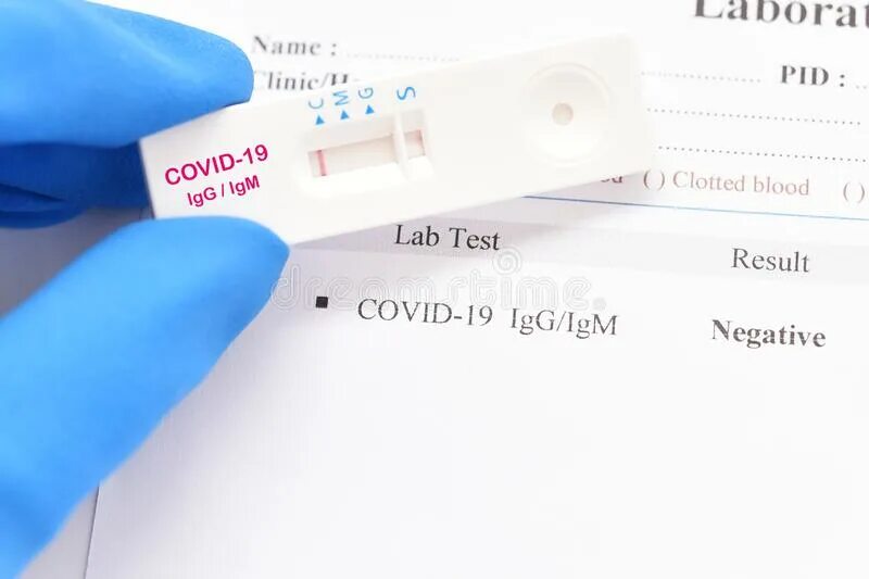 Отрицательный результат теста на вич. Covid 19 negative Test. Отрицательный тест на ВИЧ. CARESTART Covid Test negative. Экспресс тест на ВИЧ показал отрицательный результат.