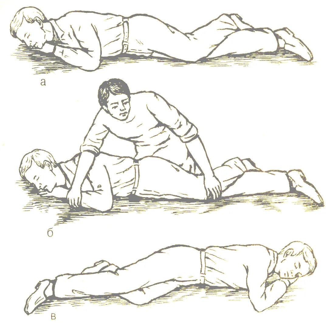 Положить набок. Положение пострадавшего на боку. Уложить пострадавшего на бок. Положение на животе пострадавшего. Лежа на больном боку.