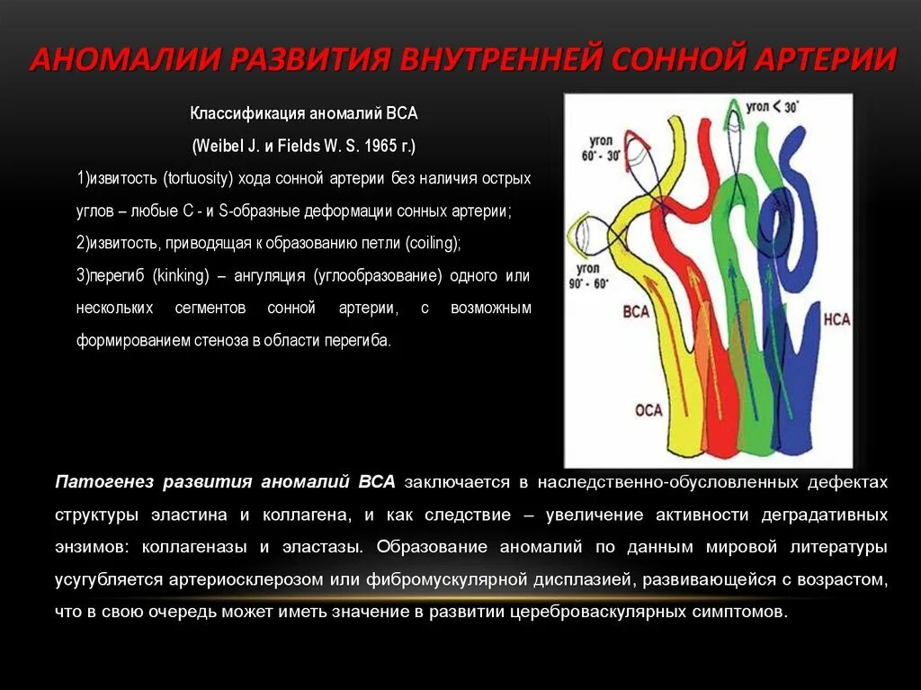 Ветви внутренней сонной артерии. Извитость сонных артерий. Извитость внутренней сонной артерии. Канал внутренней сонной артерии.