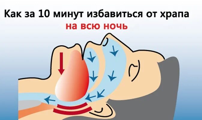 Что нужно сделать чтобы не храпеть ночью