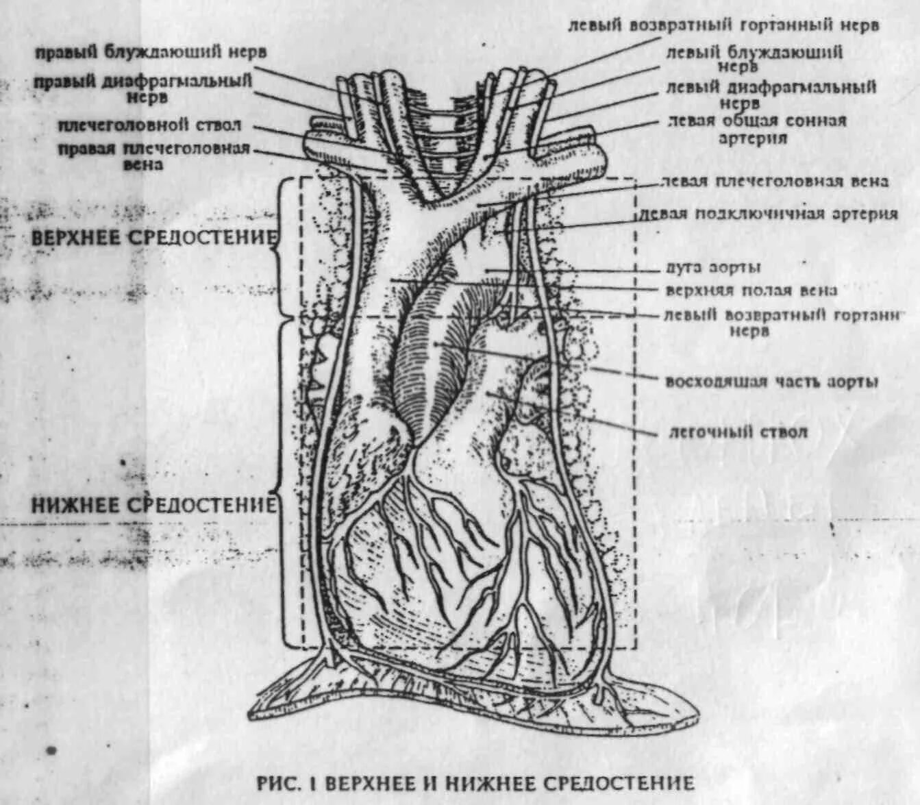 Крупные сосуды переднего средостения. Сосуды средостения топографическая анатомия. Строение средостения. Топография сосудов средостения. Сосуды переднего средостения топографическая анатомия.