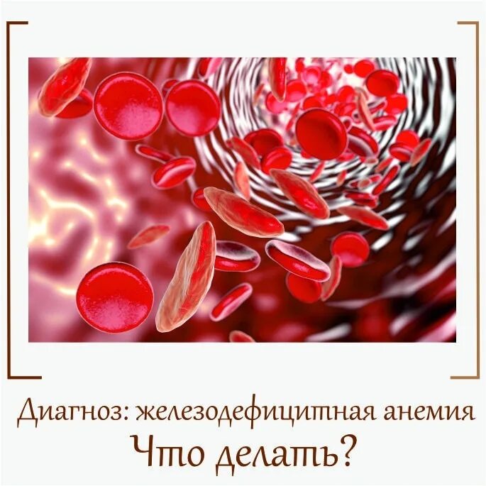 Анемия сопровождается. Анемия гемоглобин. Гемоглобин 118 это анемия. Железодефицитная анемия гемоглобин 40. Степени анемии по гемоглобину.