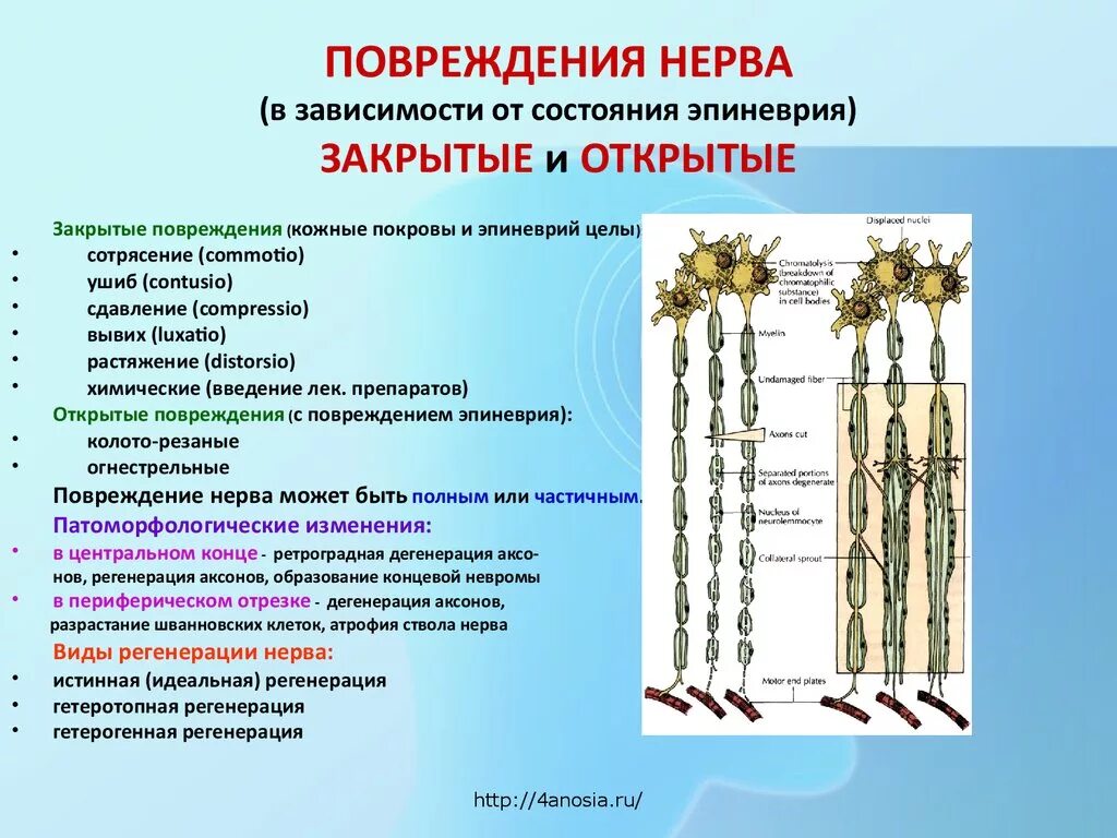 Повреждение ветви нерва