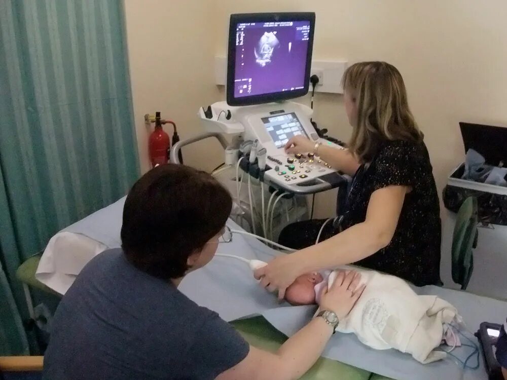 ультразвуковая допплерография головы. ультразвуковая допплерография сосудов головы. триплексное сканирование бца. ультразвуковая допплерография сосудов головы. узи уздг бца что это такое.