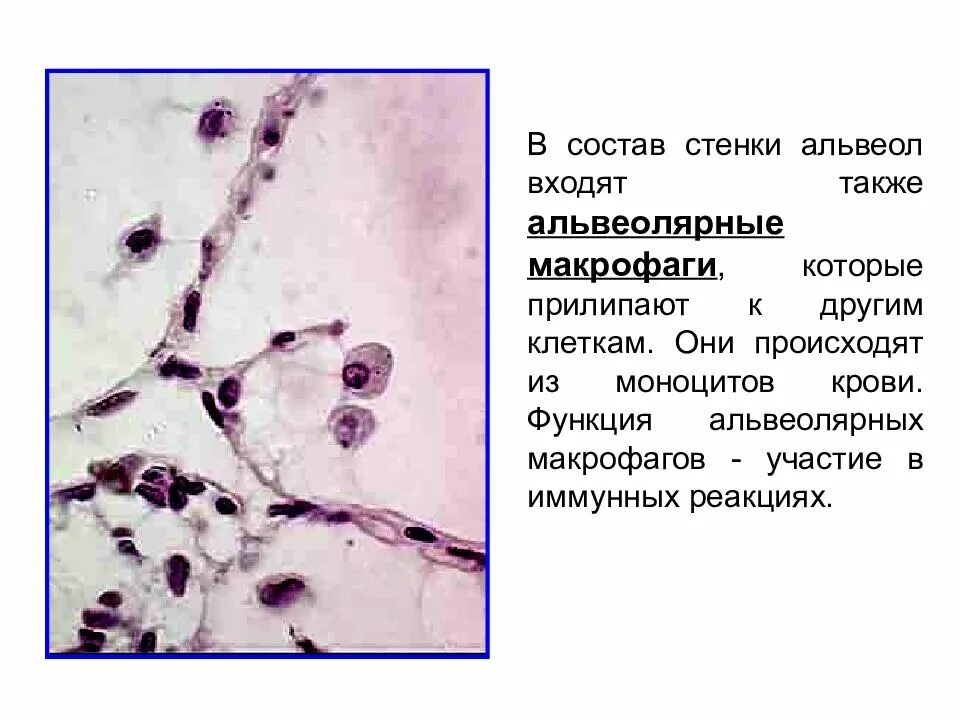 Пенистые макрофаги гистология. Макрофаги в мокроте микроскопия. Альвеолярные макрофаги микроскопия. Альвеолярные макрофаги в мокроте микроскопия.