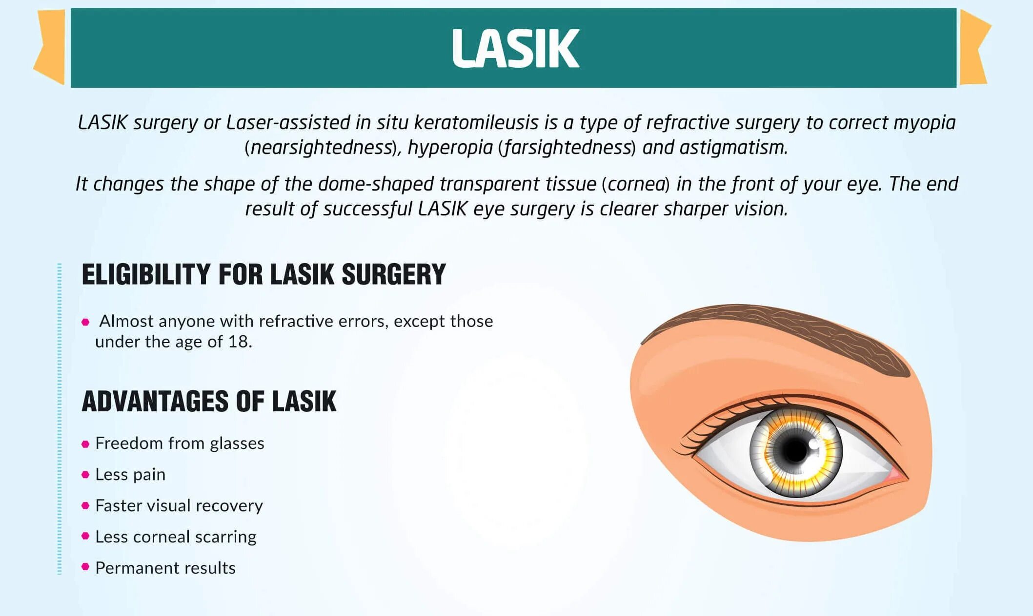 Глаз как переводится. Операция ласик на глаза при астигматизме. LASIK лазерный кератомилез.