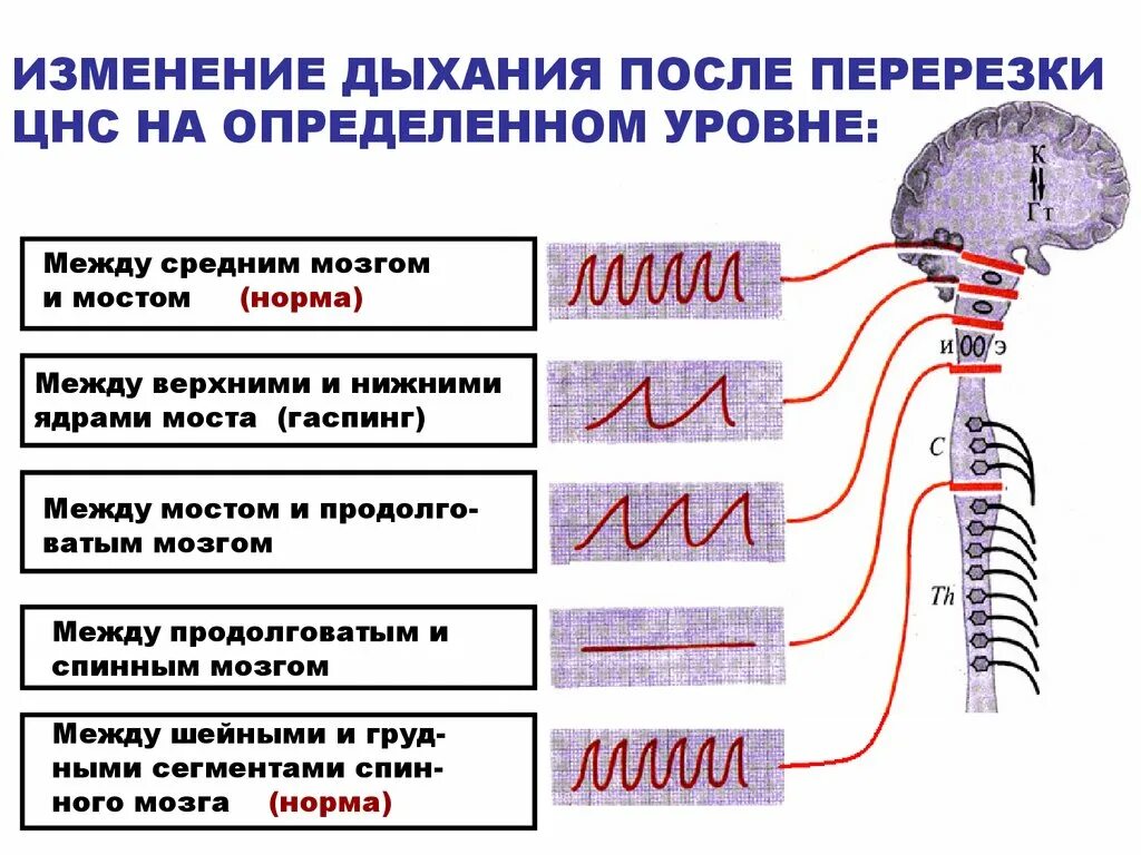 Изменения нервной системы. Изменение дыхания. Перерезка изменение дыхания. Изменение дыхания при перерезке мозга на разных уровнях.