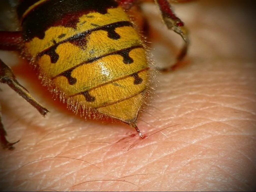 Опасны ли осы. Шмель пчела Оса Шершень укусы. Укус шершня обыкновенного. Шмель Оса Шершень.