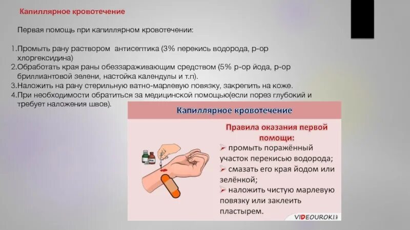 Первая помощь прикапилярных кровотечениях. Капиллярное кровотечение первая помощь. Перваятпомощь капиллярного кровотечения. Капиллярное кровотечение алгоритм оказания первой помощи.