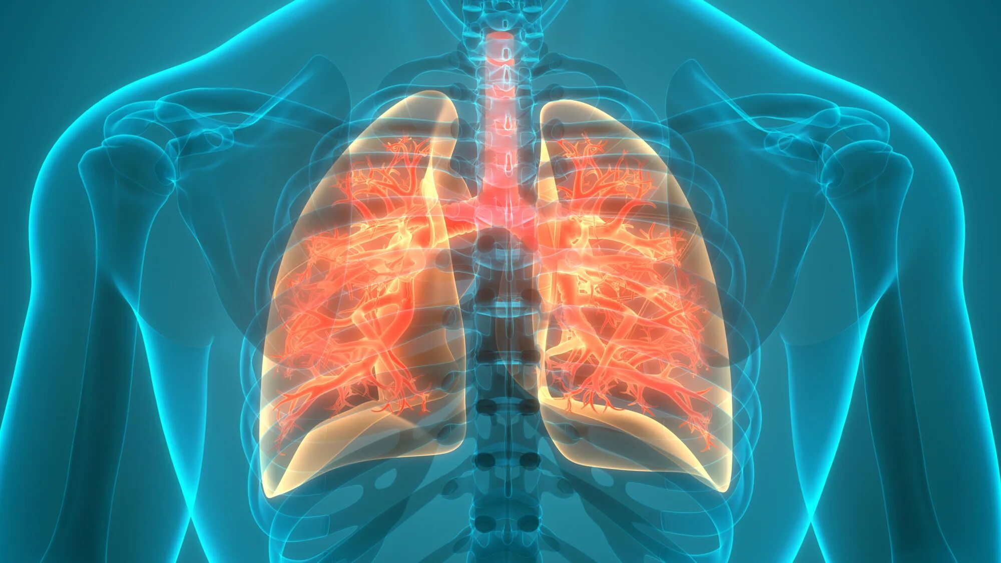 Тяжёлые заболевания лёгких. Diseases associated