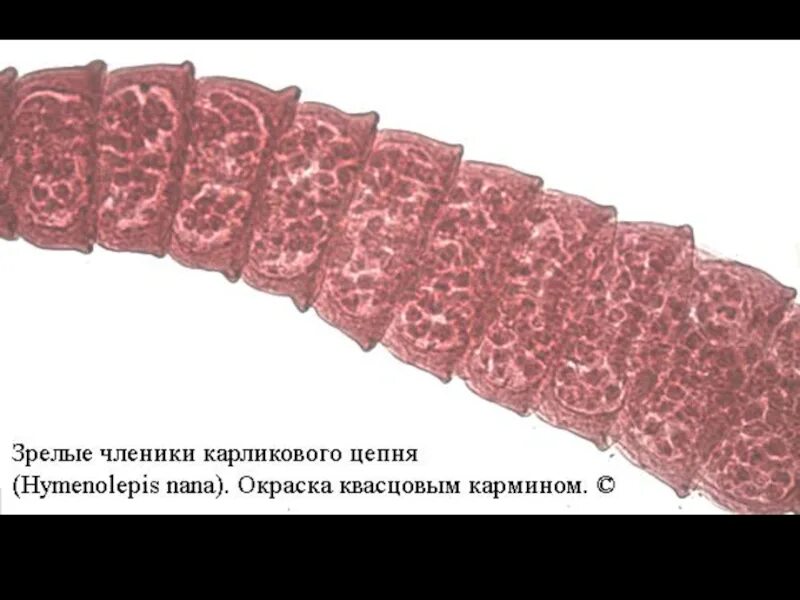 Hymenolepis Nana – карликовый цепень-гименолепидоз. Строение членика карликового цепня. Карликовый цепень проглоттиды. Бычий свиной и карликовый цепень.