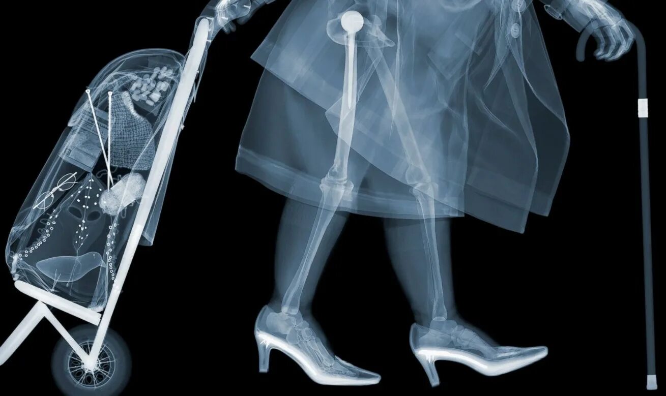 Рентген в аэропорту. Рентген животных. Прозрачная машина. Рентген nick veasey. X ray рентгеновские лучи.